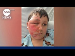 Read more about the article What parents need to know about toy warnings