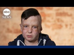 Read more about the article One child’s resilience after four years of war in Ukraine