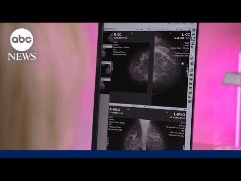 Read more about the article Mammogram screenings declining in key groups of younger women