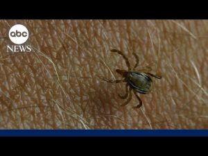 Read more about the article How to protect yourself from tick bites