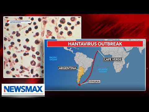 Read more about the article ‘Hantavirus is no laughing matter’: Dr. Bogoch on outbreak ravaging cruise ship