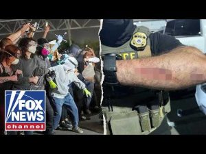 Read more about the article Rioter charged for BITING ICE officer, Blanche announces