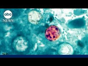 Read more about the article Health alert about cyclosporiasis parasitic infection