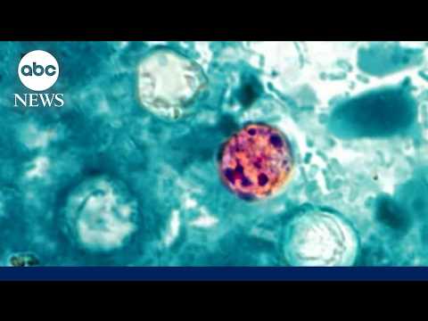 Read more about the article Health alert about cyclosporiasis parasitic infection