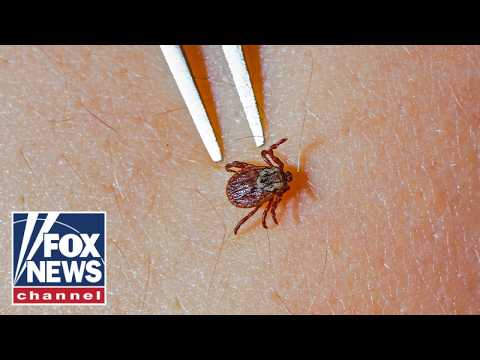 Read more about the article Rare tick-borne virus SURGES as summer camp season begins