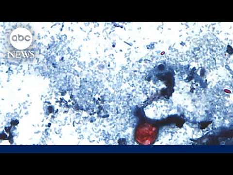 Read more about the article Cyclosporiasis outbreak raises new food safety concerns