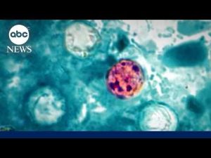 Read more about the article Cyclosporiasis cases surge after RFK Jr. said  outbreak was contained