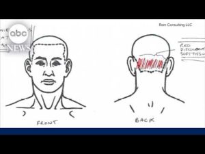 Read more about the article Nolan Wells’ cause of death ruled “undetermined” in autopsy commissioned by family