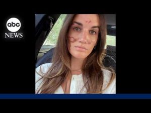Read more about the article Celebrity esthetician relinquishes license amidst lawsuit