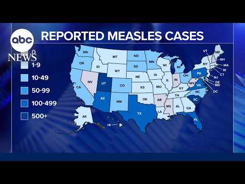 Read more about the article Measles outbreak raises alarms over vaccination rates