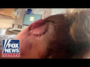 Read more about the article DoorDasher suffers skull fractures, brain bleeds after BRUTAL assault