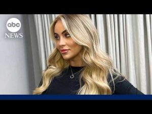 Read more about the article Why some younger women say that they are opting for facelifts
