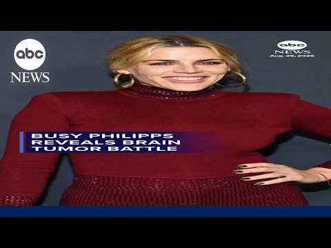 Read more about the article Busy Philipps reveals brain tumor battle